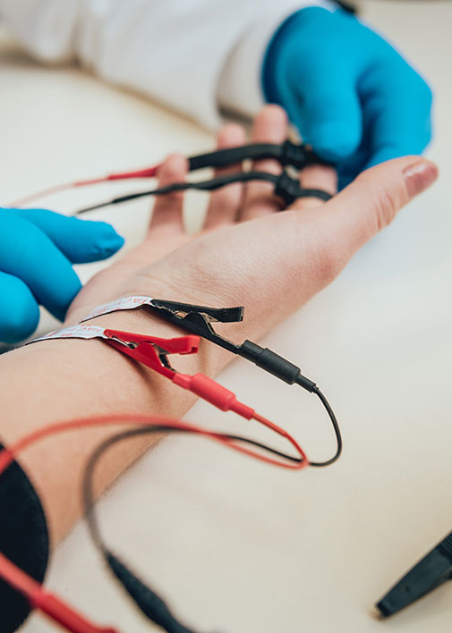 Gros plan sur l'avant-bras d'un patient qui passe un électromyogramme