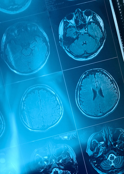 IRM de la portion frontal du cerveau