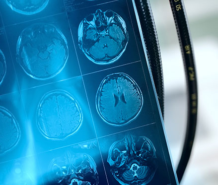 IRM de la portion frontal du cerveau