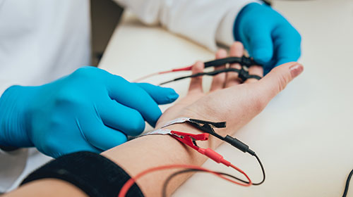 Gros plan sur l'avant-bras d'un patient qui passe un électromyogramme