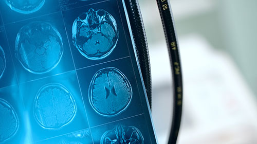 IRM de la portion frontal du cerveau