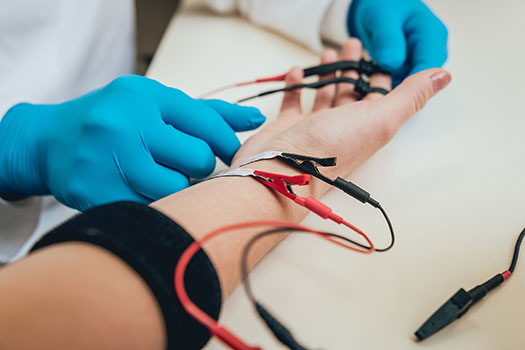Gros plan sur l'avant-bras d'un patient qui passe un électromyogramme